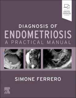 Diagnosis of Endometriosis: A Practical Manual (EPUB)