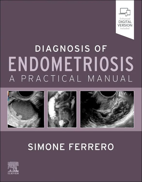 Diagnosis of Endometriosis: A Practical Manual (EPUB) Diagnosis of Endometriosis: A Practical Manual (EPUB)