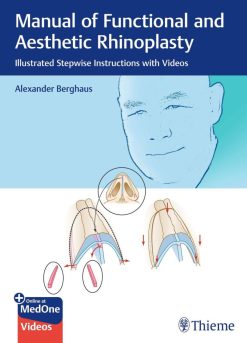 Manual of Functional and Aesthetic Rhinoplasty Illustrated Stepwise Instructions with Videos (Original PDF from Publisher+Videos)