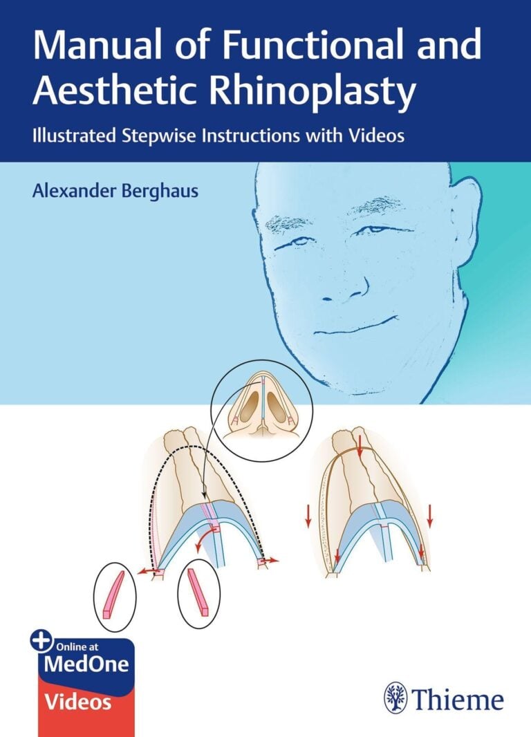 Manual of Functional and Aesthetic Rhinoplasty: Illustrated Stepwise Instructions with Videos (Original PDF from Publisher+Videos) Manual of Functional and Aesthetic Rhinoplasty Illustrated Stepwise Instructions with Videos (Original PDF from Publisher+Videos)