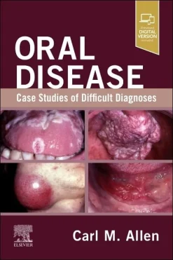 Oral Disease: Case Studies of Difficult Diagnoses (True PDF)