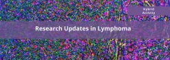 Cedars Sinai Research Updates in Lymphoma 2024