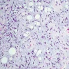 Cleveland Clinic Comprehensive and Immersive Soft Tissue Pathology 2025 Cleveland Clinic Comprehensive and Immersive Soft Tissue Pathology 2025