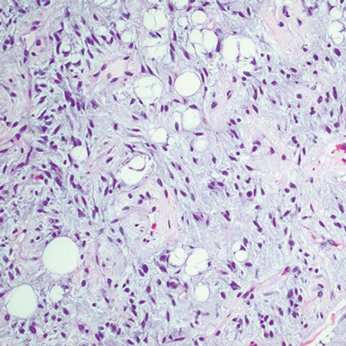 Cleveland Clinic Comprehensive and Immersive Soft Tissue Pathology 2025 Cleveland Clinic Comprehensive and Immersive Soft Tissue Pathology 2025