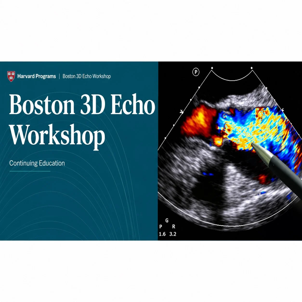 Harvard Boston 3D Echo Workshop 2025 Harvard Boston 3D Echo Workshop 2025