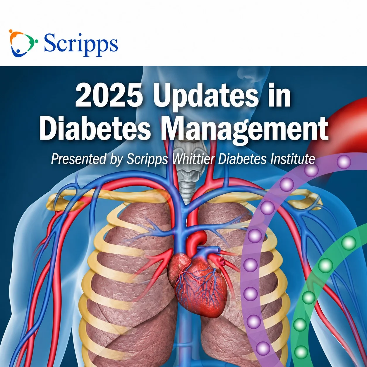 Scripps Updates in Diabetes Management 2025 Scripps Updates in Diabetes Management 2025