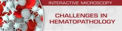 USCAP Challenges in Hematopathology 2019