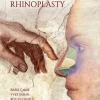 Preservation Rhinoplasty 2023 Preservation Rhinoplasty 2023