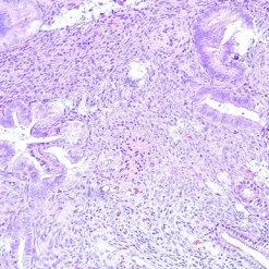 Oakstone Gynecologic Pathology 2026
