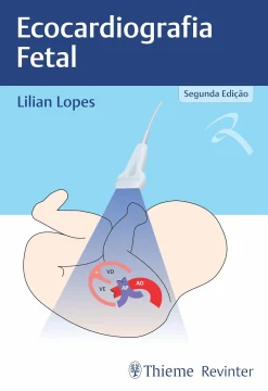 Ecocardiografia Fetal (Portuguese Edition) (EPUB and pdf)