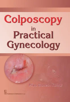 Colposcopy in Practical Gynecology (EPUB and pdf)