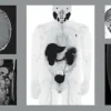 UCSF Radiology Annual Review – 2024 UCSF Radiology Annual Review – 2024