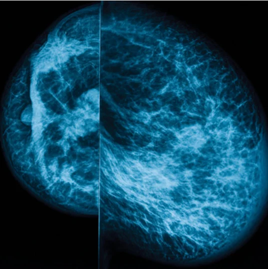 UCSF Breast Imaging 2024 UCSF Breast Imaging 2024