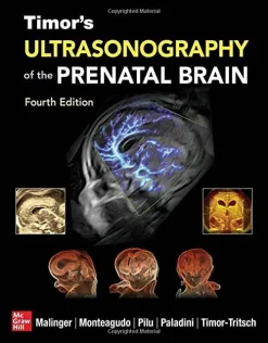 Timors Ultrasonography of the Prenatal Brain 4th edition Original PDF from Publisher