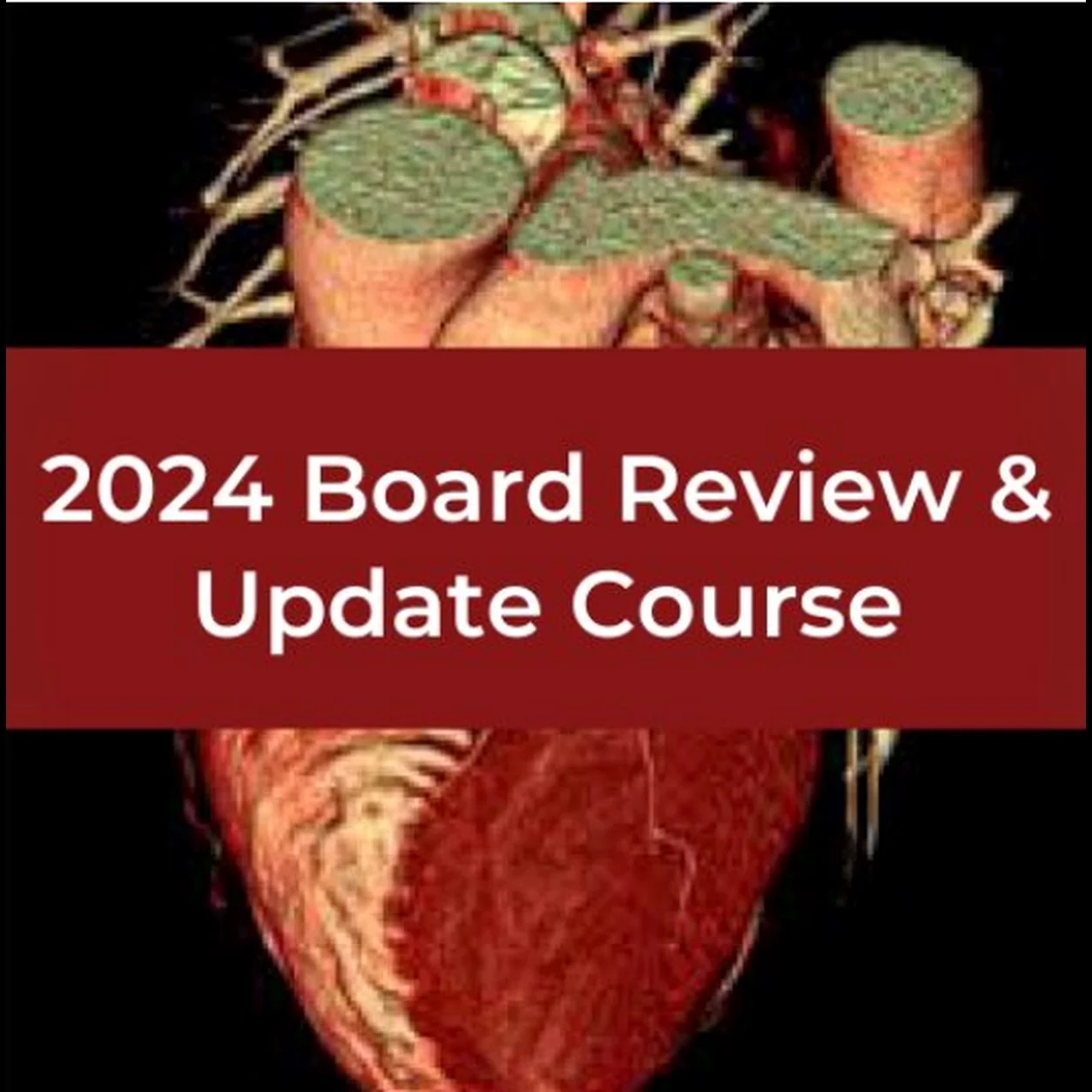 SCCT 2024 Board Review and Comprehensive Update of CCT Course SCCT 2024 Board Review and Comprehensive Update of CCT Course
